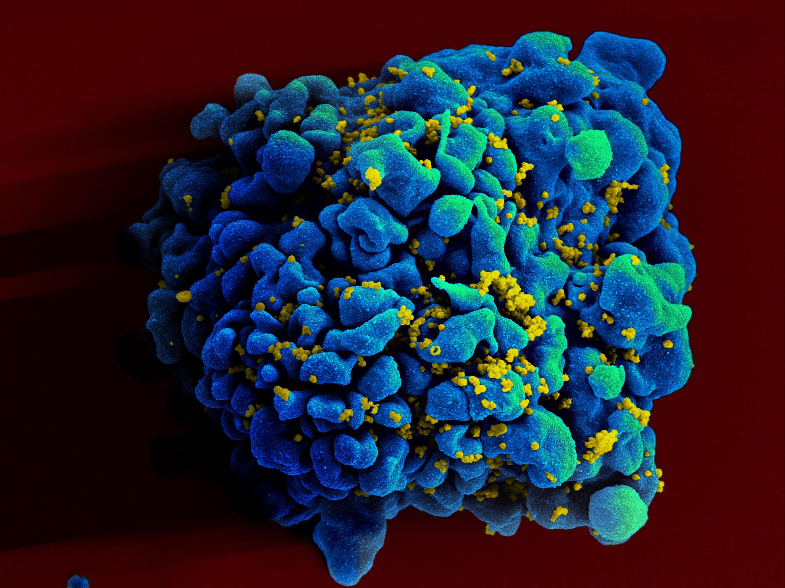 If the research teams manage to reproduce a response that produces antibodies against all strains of HIV, they could create a universal vaccine.