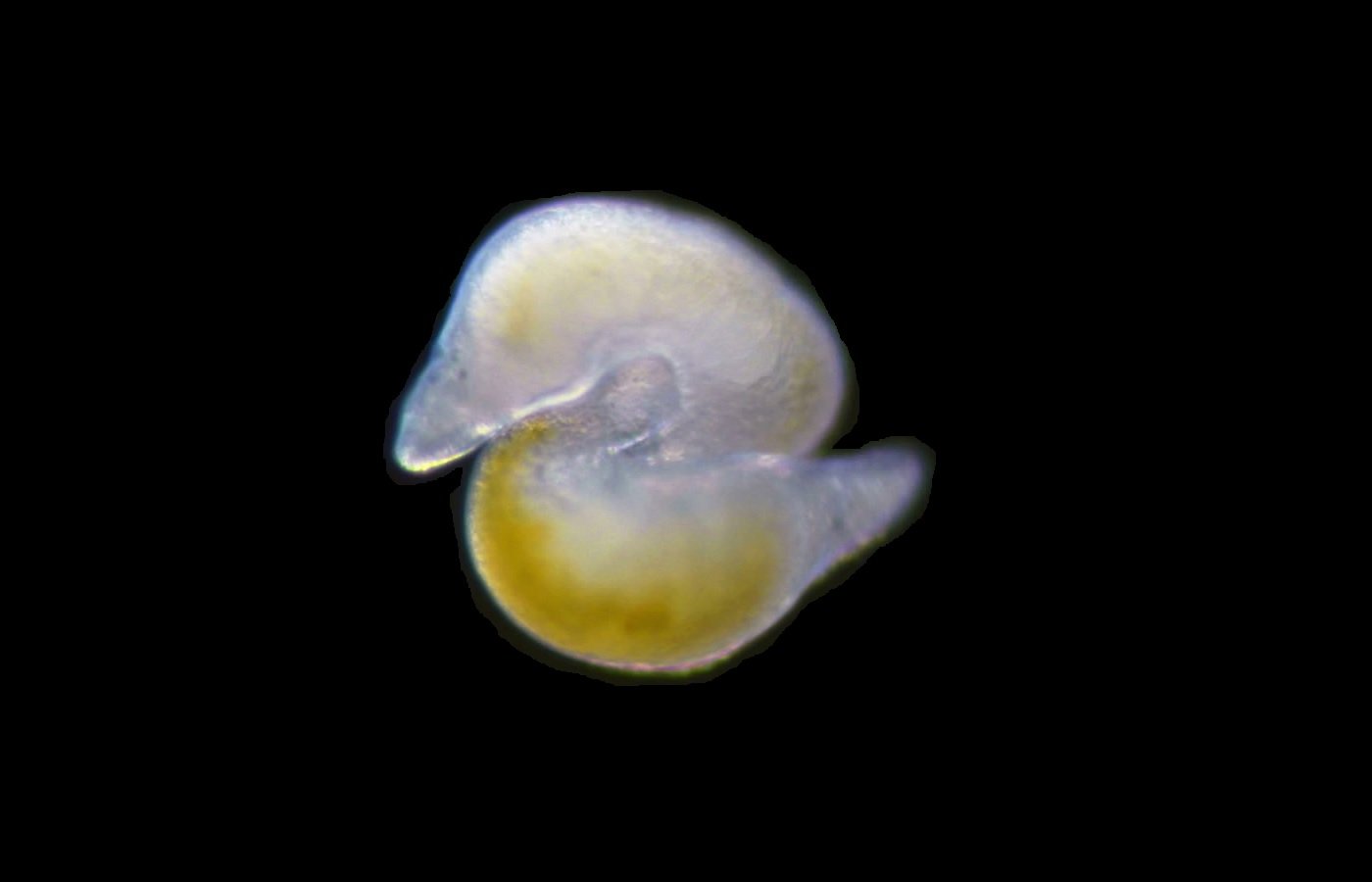 The regenerative abilities of the flatworm Macrostomum lignano serve as a model for how humans might regenerate tissues.
