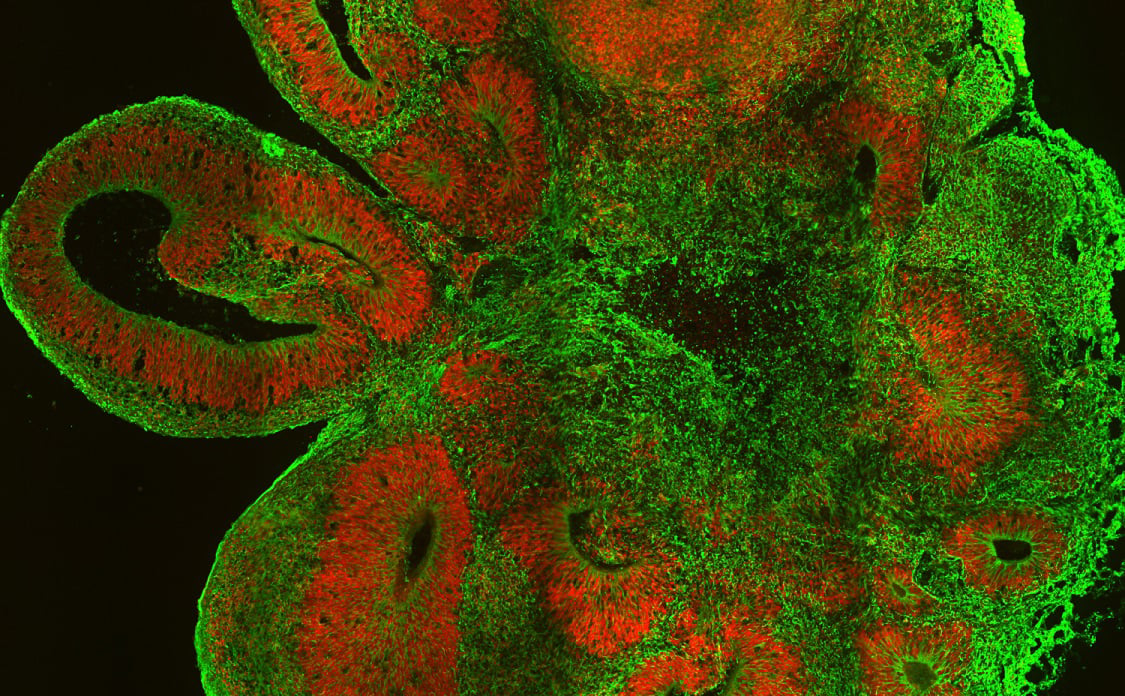 Cerebral organoids allow scientists to test new drugs on human brain tissue in labs.