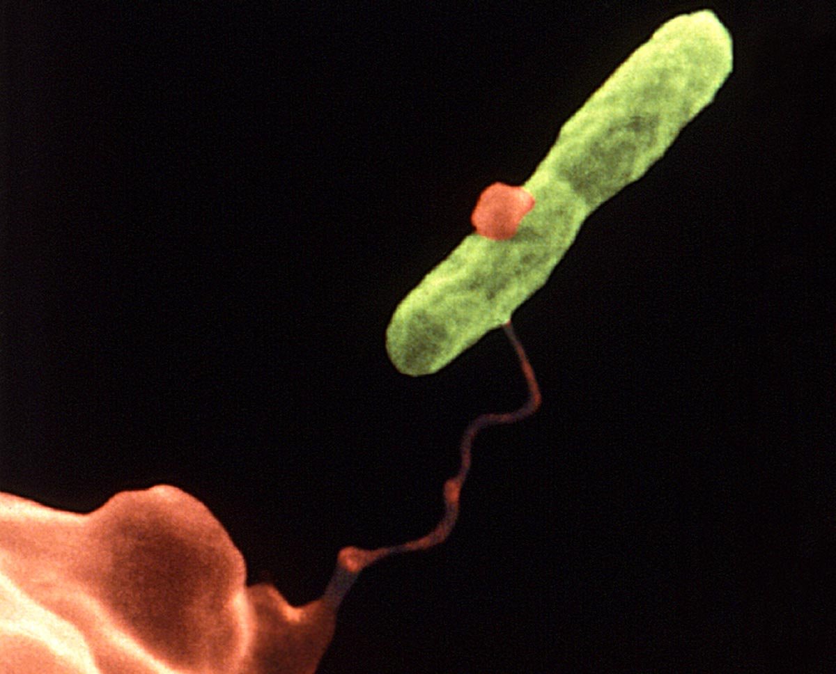 Legionella cells can be detected with a home-printer-size testing machine. Image credit - CDC/ Dr. Barry S. Fields