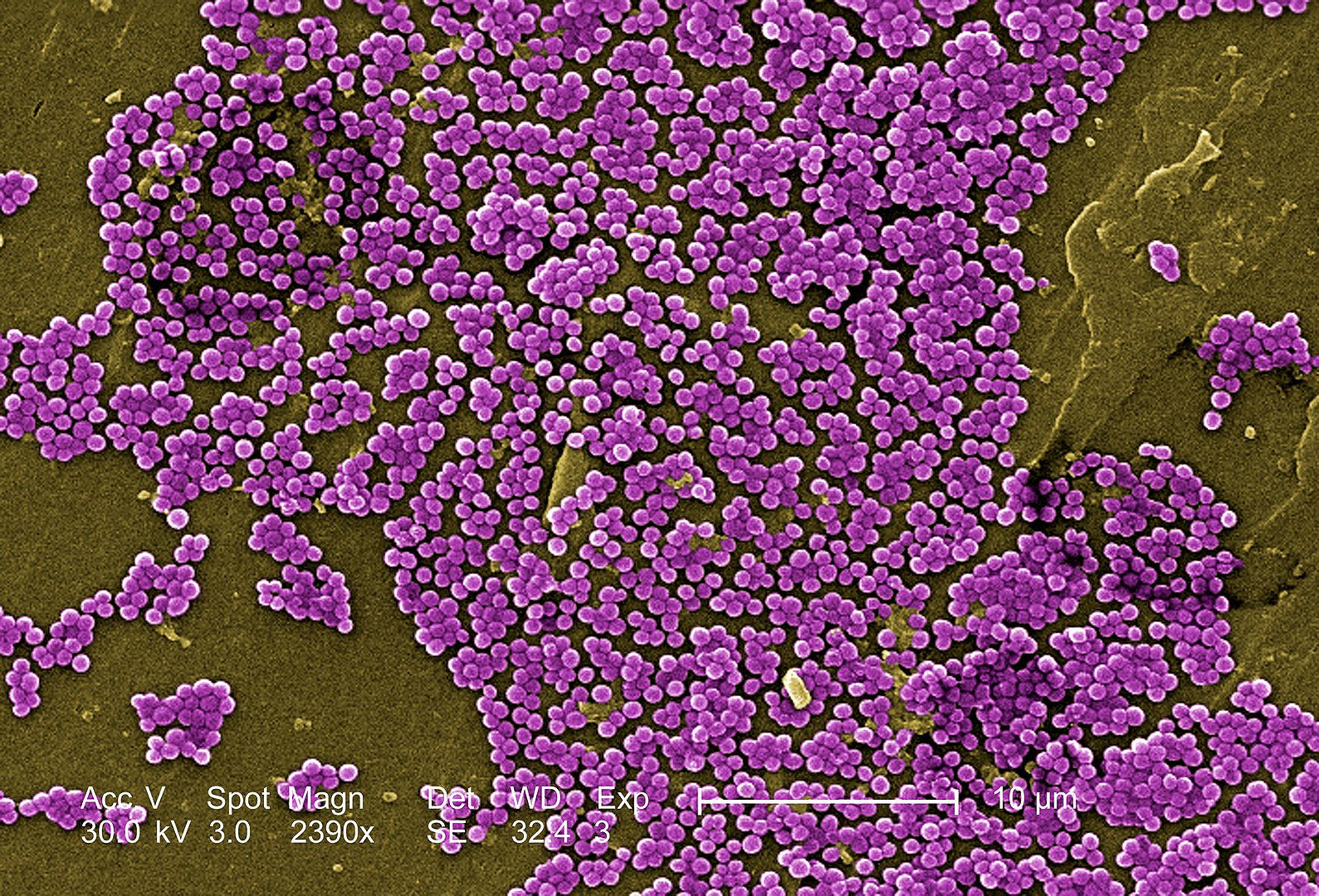 Methicillin-resistant Staphylococcus aureus (MRSA) have had their antibiotic resistance reversed in Prof. Almqvist's lab. Image credit - Pixnio/ Janice Haney Carr, Jeff Hageman, M.H.S, USCDCP, licensed under CC0