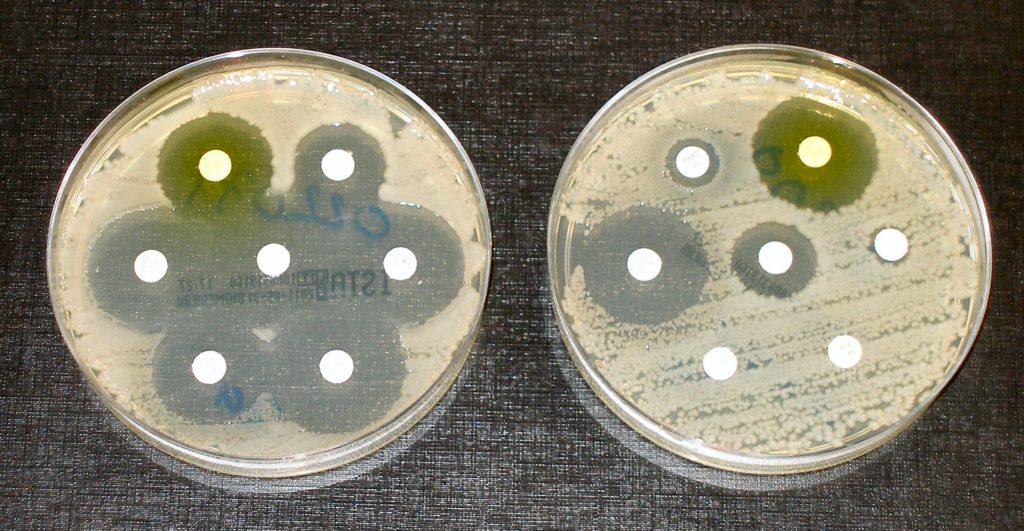 When bacteria develop antibiotic resistance (in the dish on the right), they can grow even in the presence of antibiotics (in the white discs). Image credit - Dr Graham Beards, licensed under CC BY-SA 4.0