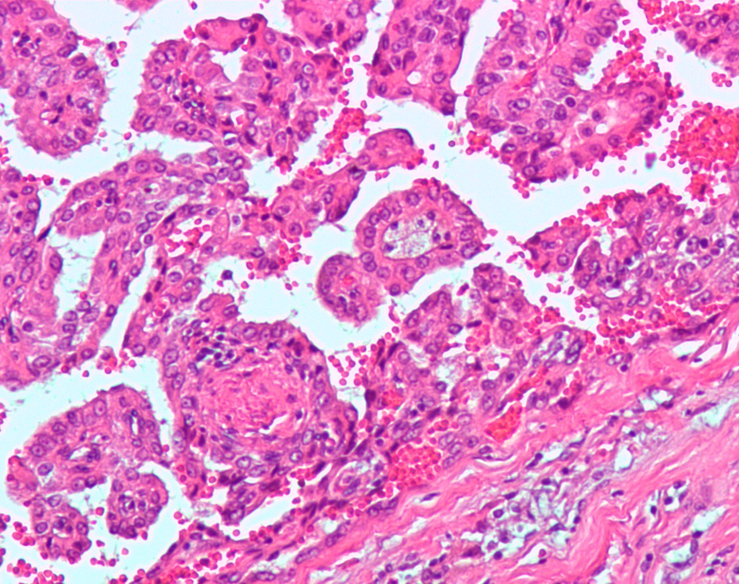 Basic research into hypoxia is helping to find mechanisms that would starve cancer of the oxygen it needs to grow. Image credit - Nephron, licensed under CC BY-SA 3.0