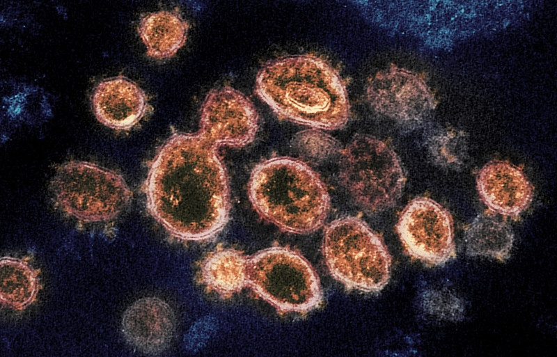 If researchers could find the most effective antibody against coronavirus, it could act as both a cure and temporary vaccine. Image credit - NIH Image Gallery, Public Domain Mark 1.0