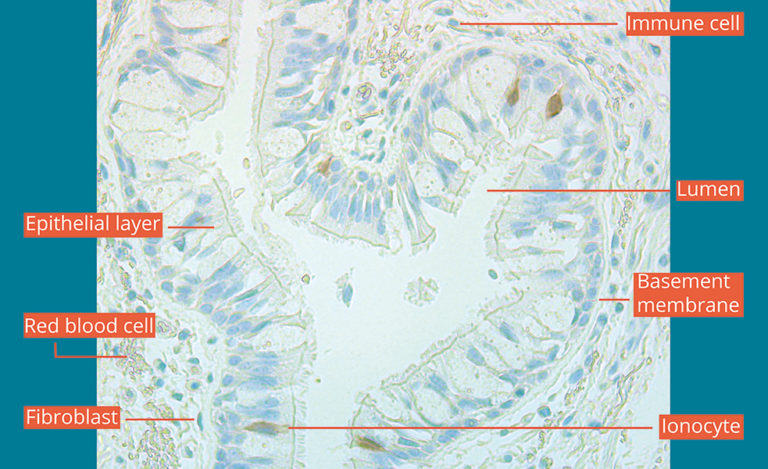 In a picture: The quest to map all the cell types in a human lung ...